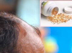 Mungesa e vitaminës D: Shenja paralajmëruese në kokën tuaj