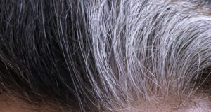 Pse thinjen flokët? pse-thinjen-floket?