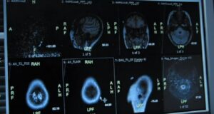 Duke fajësuar veten, rrezikoni shëndetin tuaj duke-fajesuar-veten,-rrezikoni-shendetin-tuaj