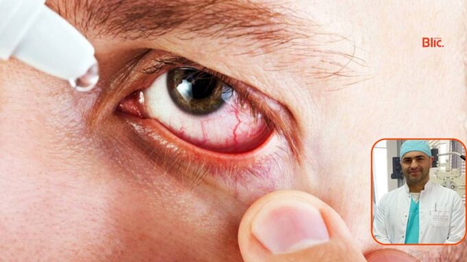 infeksionet-e-syrit:-simptomat,-shkaqet-dhe-trajtimi-efektiv-–-oftalmologu-hajdari-jep-detaje