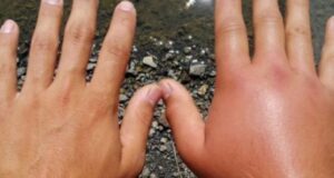 Të gjitha ndryshimet në trup që ndodhin si pasojë e motit te-gjitha-ndryshimet-ne-trup-qe-ndodhin-si-pasoje-e-motit