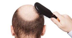 Zbulohet shërimi kundër rënies së flokëve zbulohet-sherimi-kunder-renies-se-flokeve