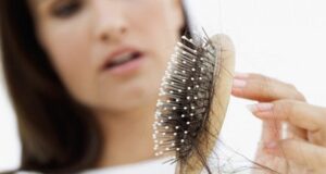 Faktorët e rënies së flokëve faktoret-e-renies-se-flokeve