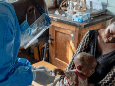 Në epiqendrën e mpox: Infermieret po punojnë me frikë ne-epiqendren-e-mpox:-infermieret-po-punojne-me-frike