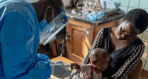 Në epiqendrën e mpox: Infermieret po punojnë me frikë ne-epiqendren-e-mpox:-infermieret-po-punojne-me-frike