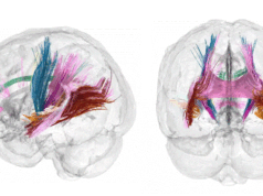 Skanimet kapin riorganizimin gjithëpërfshirës të trurit në shtatzëni skanimet-kapin-riorganizimin-gjitheperfshires-te-trurit-ne-shtatzeni