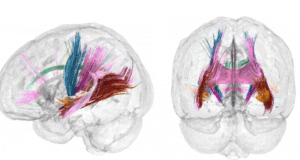 Skanimet kapin riorganizimin gjithëpërfshirës të trurit në shtatzëni skanimet-kapin-riorganizimin-gjitheperfshires-te-trurit-ne-shtatzeni