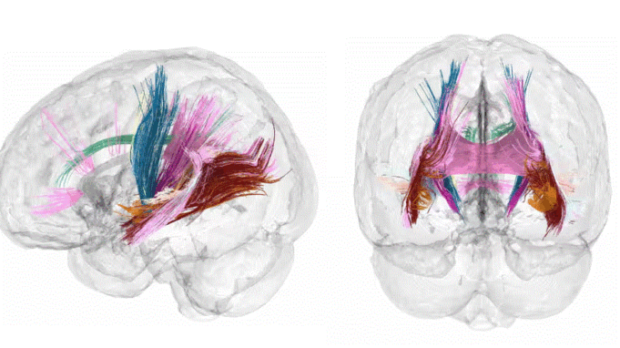 skanimet-kapin-riorganizimin-gjitheperfshires-te-trurit-ne-shtatzeni