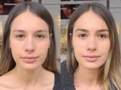 Çfarë duhet të dini para se të bëni vetullat microblanding cfare-duhet-te-dini-para-se-te-beni-vetullat-microblanding