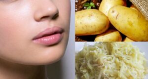 Maskat me patate, fantastike për fytyrën maskat-me-patate,-fantastike-per-fytyren
